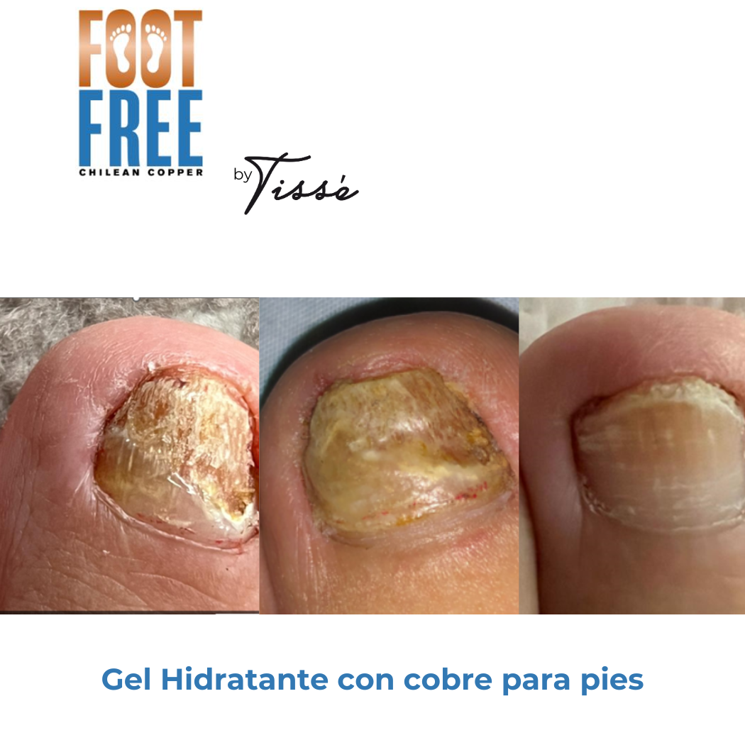 ** Foot Free Gel para pies ** (solo disponible envío en 24-48 horas)